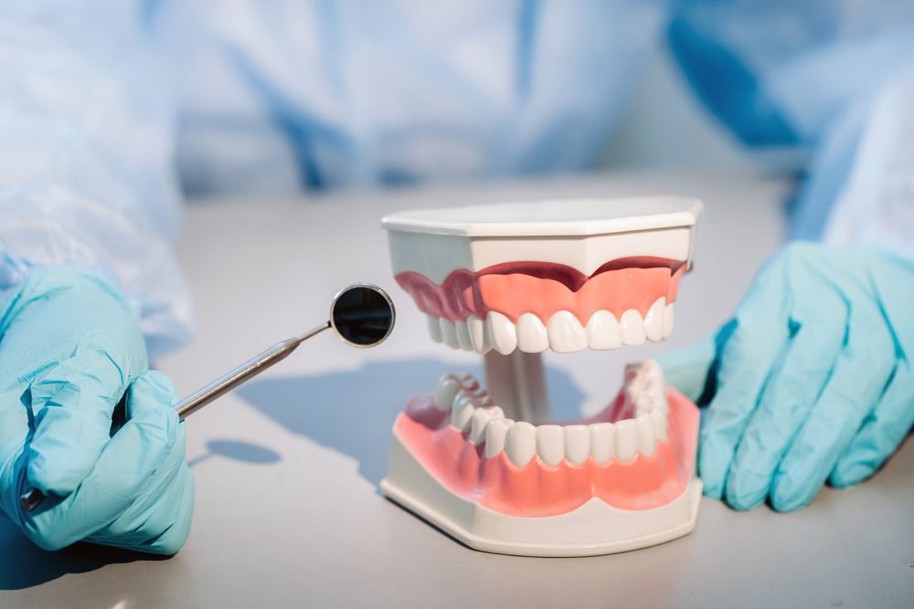 Cele mai uimitoare fapte despre dinti - Ai 16 dinti inferiori si 16 superiori